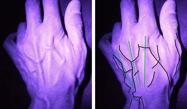 Ground-breaking interrogation of hand anatomy to help identify child abusers Lancashire-hands